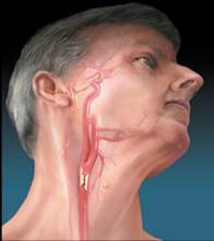 脑供血不足怎么防治,脑供血不足常敲打3个穴位