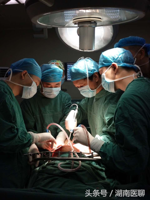 湖南女子腰间长“足球”大肿瘤进超市被怀疑偷东西