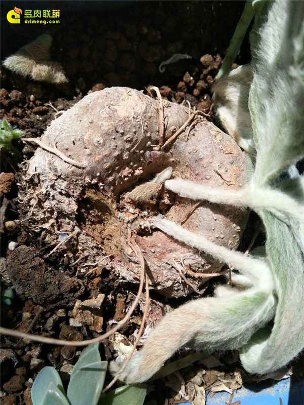 一个脚气患者的真实故事,关于癣有趣的故事