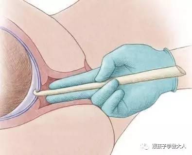 顺产时遇到的那些事,顺产也觉得心疼