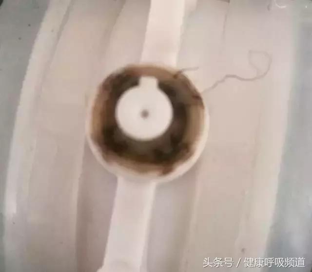 至简清肺仪对肺气肿人有效吗,肺大泡或肺气肿能不能使用清肺仪