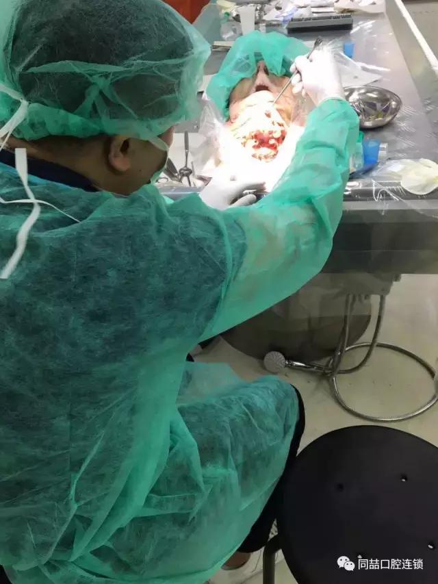 瑞士进口种牙方案,牙医日常最大限度保留原生牙