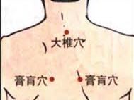 宝宝支气管肺炎怎么办?学会推拿让宝宝少受罪!