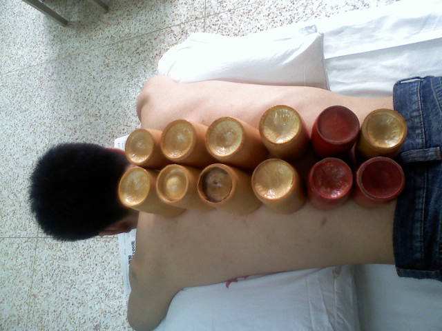 背痛有很多，伤筋最常见，这些方法很管用，但却很少人知道！