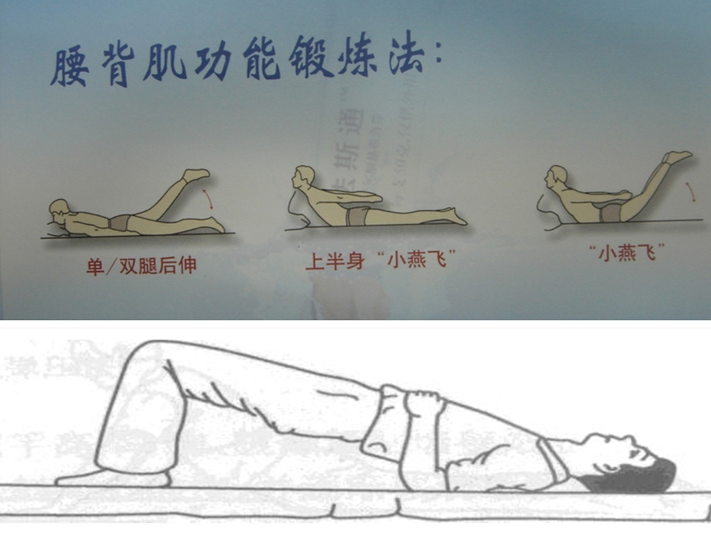 背痛有很多，伤筋最常见，这些方法很管用，但却很少人知道！