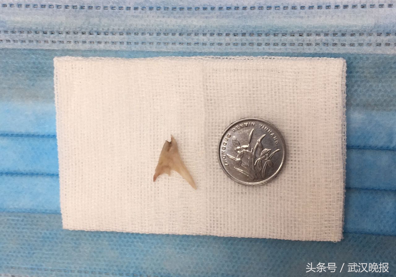 宝宝反复低烧咳嗽可以打针吗,咳嗽发烧打了5天阿奇不见好