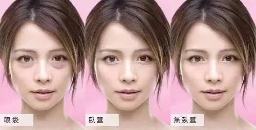 怎样区分眼袋卧蚕和双眼皮,怎样区分卧蚕和眼袋最简单的方法
