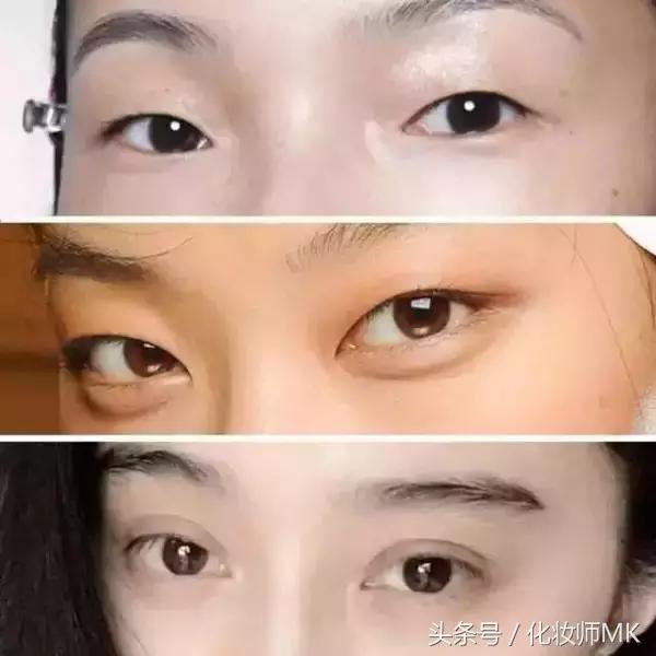 真实贴双眼皮贴,单眼皮怎么贴第二天变双眼皮