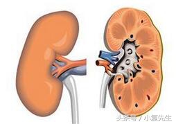 肾小球肾炎中医辨证,中医治疗肾病尿蛋白怎么治