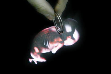 上环的避孕原理就是相当于刮宫吗,上环是刮宫还是不刮环