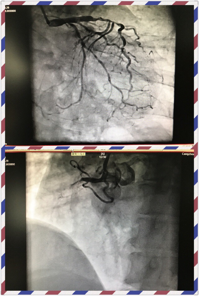 医生有没有权力抓病人,医生有拒绝患者住院的权利吗