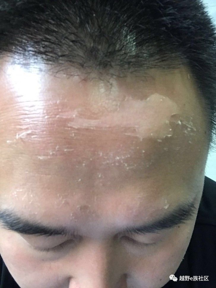 灏忛噾鐗涘巶,灏忛噾鐗涙満姊板巶