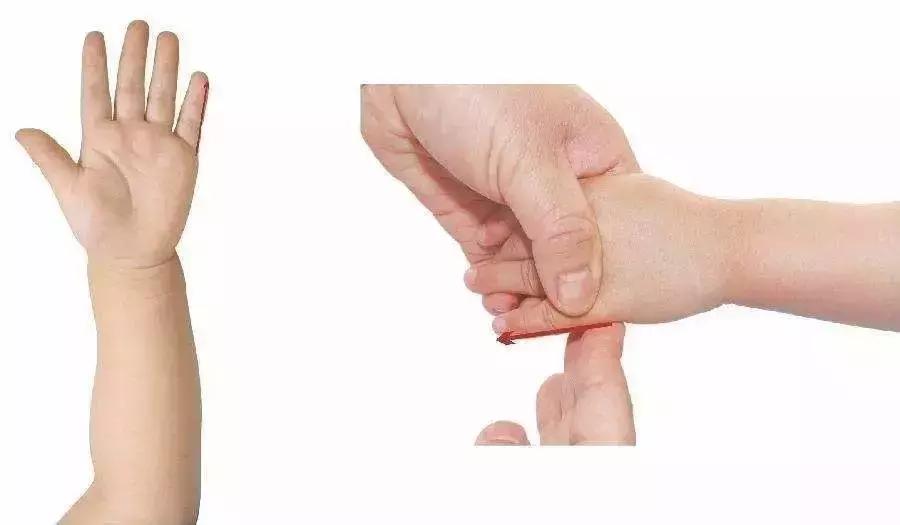 小儿推拿按哪个穴位治疗肠鸣,小儿肠鸣肚子疼是怎么回事