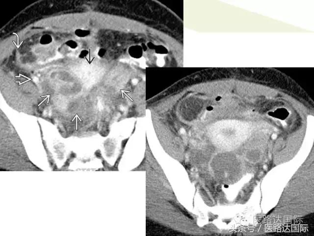 北京妇产医院梁宇霆,北京妇产医院梁宇霆出诊