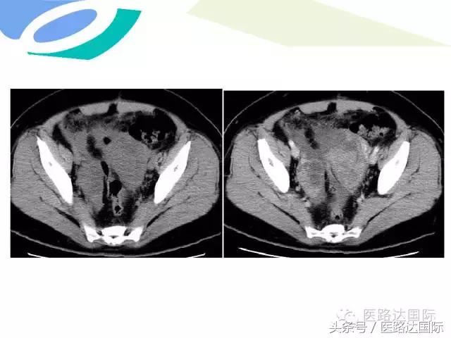 北京妇产医院梁宇霆,北京妇产医院梁宇霆出诊