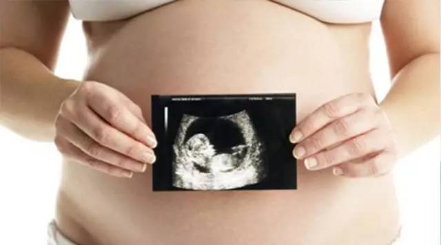 四维彩超查出胎儿不正常的指标,四维彩超看不出唐氏儿