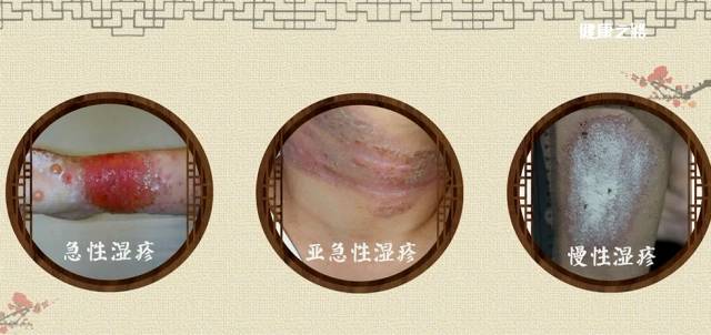 健康之路中医治痛有妙招,健康之路小经方大智慧