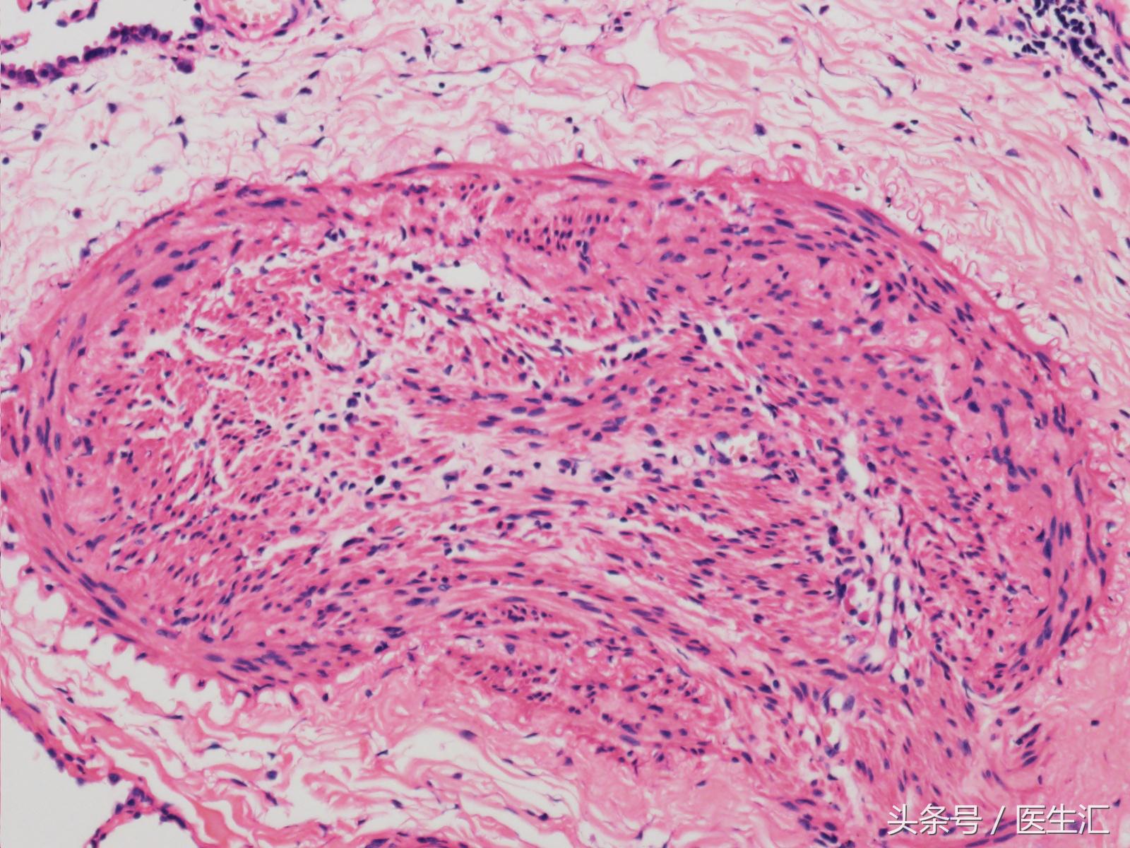 两年了老是咳嗽怎么回事,老人稍微活动气急气喘怎么办