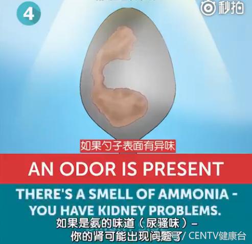 一个勺子，花一分钟知道你身体好不好