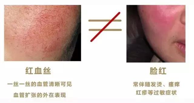 如何去除红痕,怎么去除红颜料