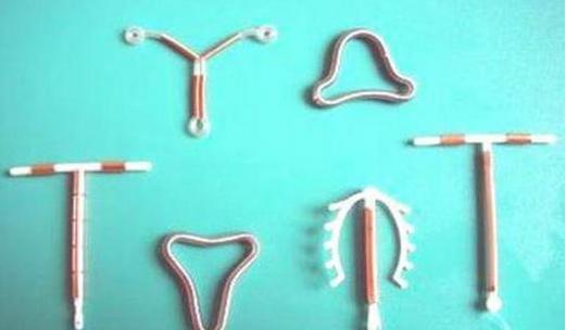 女性取环是一种怎样的体验呢？心疼女人一万遍！