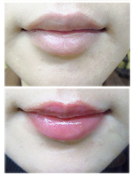 深圳纹绣漂唇什么时候做好,纹绣漂唇针法视频