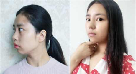 警惕微整形陷阱,整形美容的风险防范措施