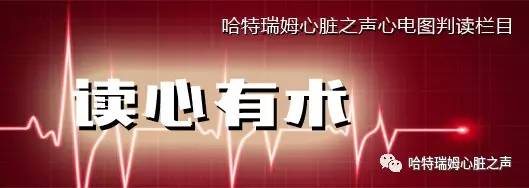 读心有术171,读心有术心电图