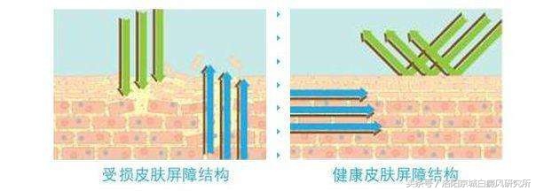 摩擦会导致白癜风病情加重吗,摩擦引起白癜风