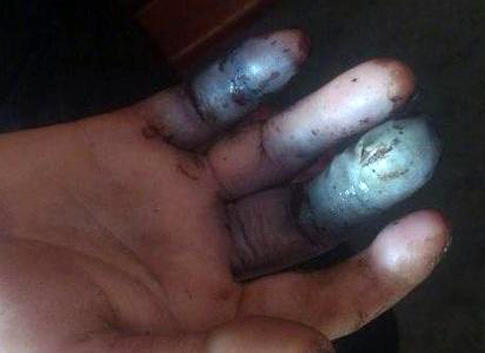 最全防蛇指南之如何防止被蛇咬伤,钓鱼途中遇到水蛇怎么办