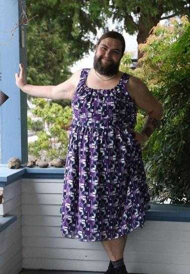 13岁女孩长满络腮胡一度不想活，直到遇见非洲男友重拾自信