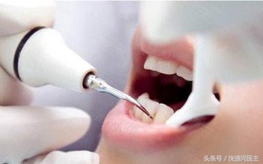 拔牙禁忌拔牙前后你需要注意什么,拔牙后疼痛会持续多久可以吃什么