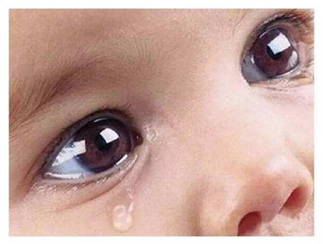 7个月婴儿泪腺不通要动手术吗,新生儿泪腺管不通怎么办