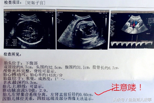 b超显示宝宝肾不一样大,b超多久能看清胎儿肾脏