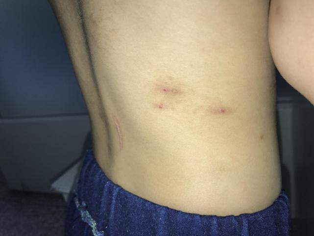 跳蚤效应小故事讲述,跳蚤的故事启示