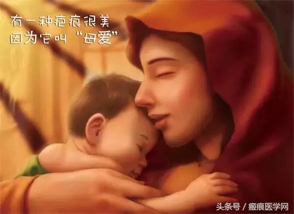 杜新枝剖腹产疤痕,剖腹产疤痕祛疤膏