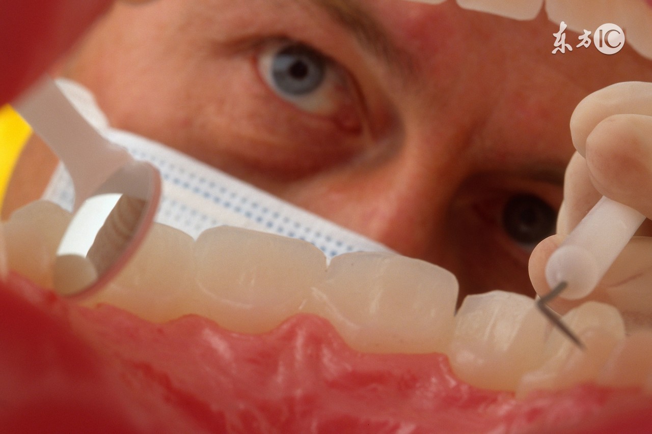 什么是种植牙,什么是种植牙的5+2模式