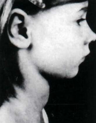 体检发现有甲状腺结节怎么办,体检出甲状腺结节能吃海带吗