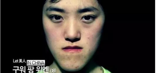 韩国整容手术恢复过程,韩国一个整容的综艺节目