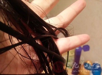 怎样去头皮屑用它煮水洗头头皮屑竟不见了