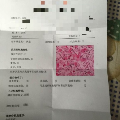 月经推迟是不是妇科有问题,月经推迟是大病吗