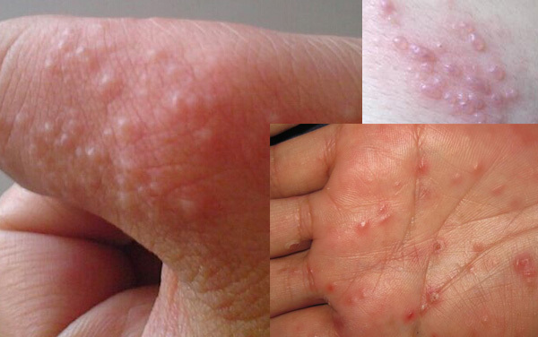 李铁红大夫专业,李铁红医生靠谱吗