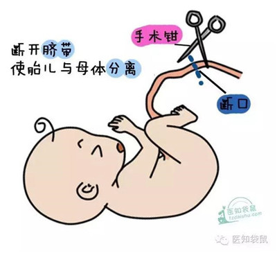 剖腹产挨几刀,剖腹产需要开几刀