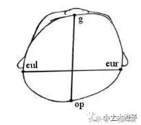 美国的宝宝扁头为什么要矫正,扁头在国外要做矫正吗