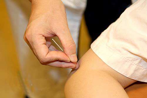 挑痧疗法大全,刮痧疗法挑痧