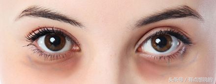 端午特刊｜如何对抗黑眼圈这个一生之敌？