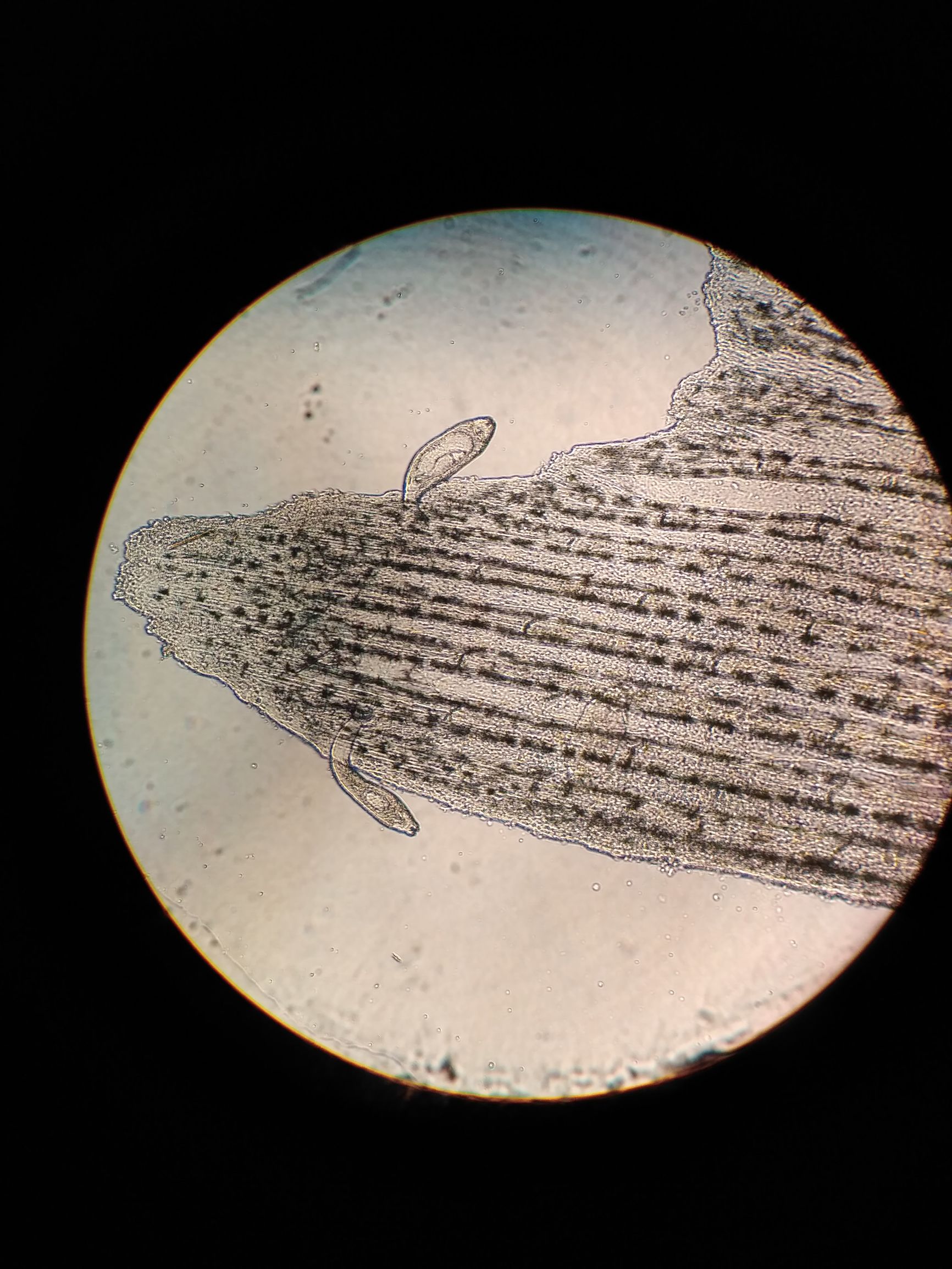 鲫鱼寄生虫防治,鱼苗感染车轮虫的症状