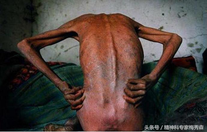 戒毒时身体感觉疼痛怎么办,社区戒毒期间有什么不适