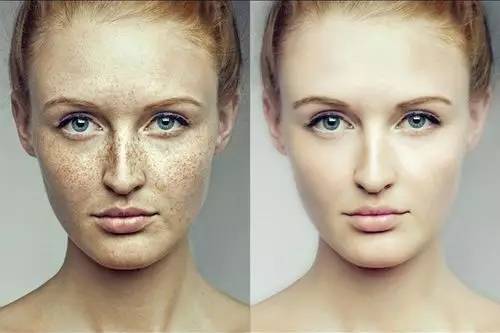 我满脸全是雀斑怎么办,满脸雀斑的我蜕变说说