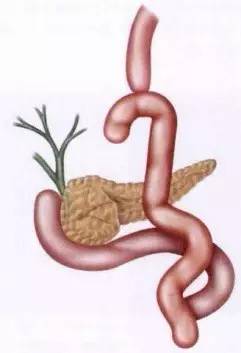 胃镜预处理流程,胃镜内镜手术全流程